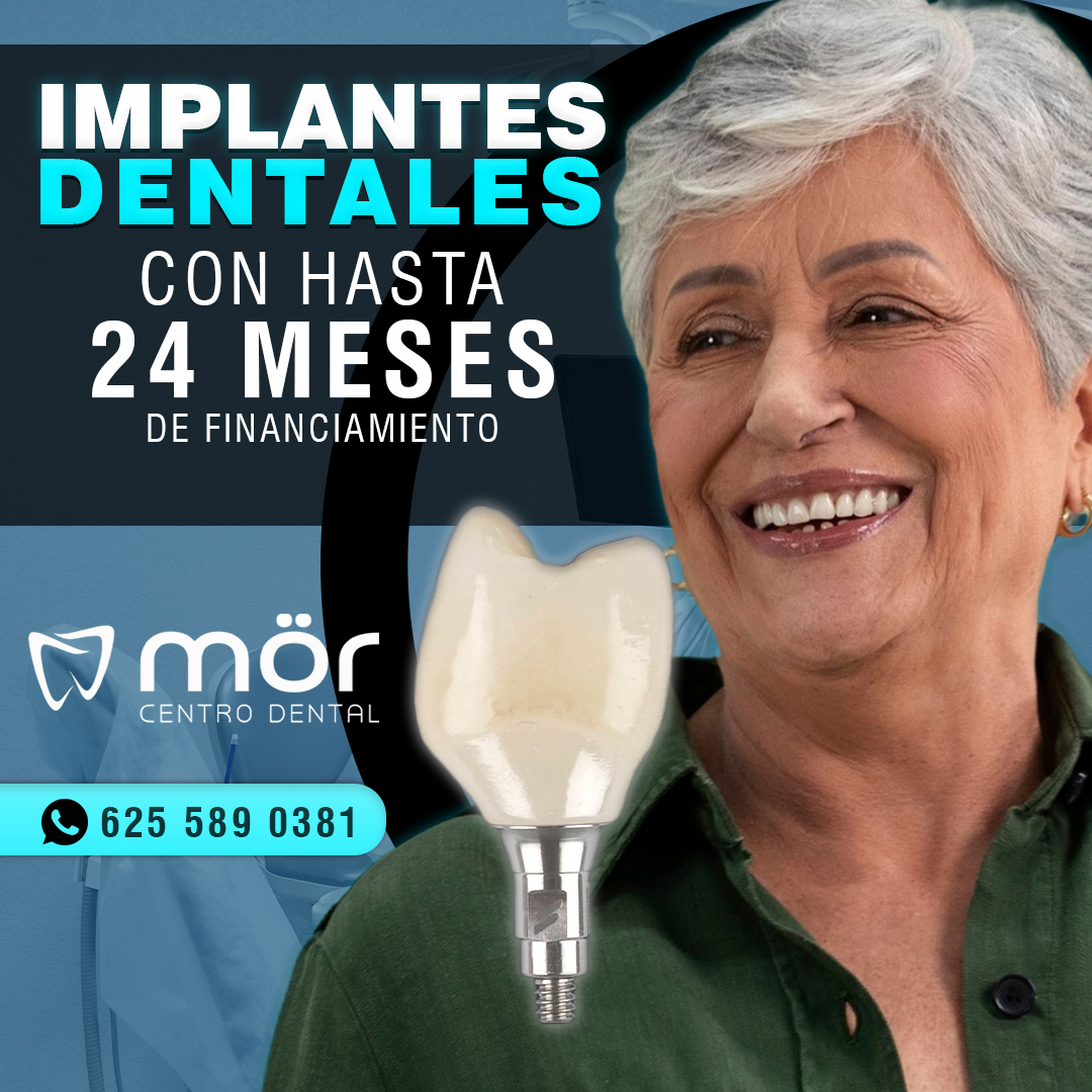 Implantes dentales con hasta 24 meses de financiamiento