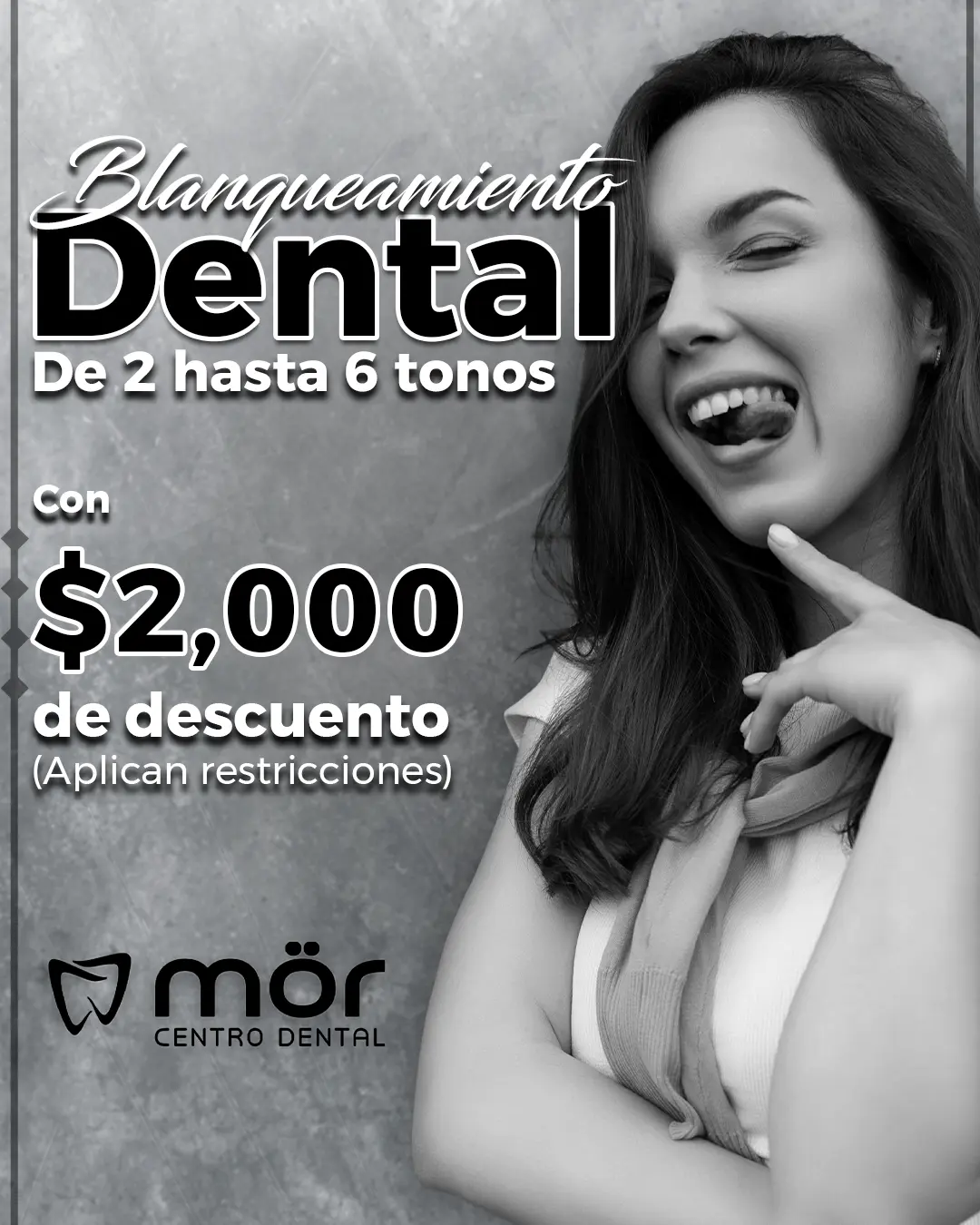 Promoción blanquamiento dental