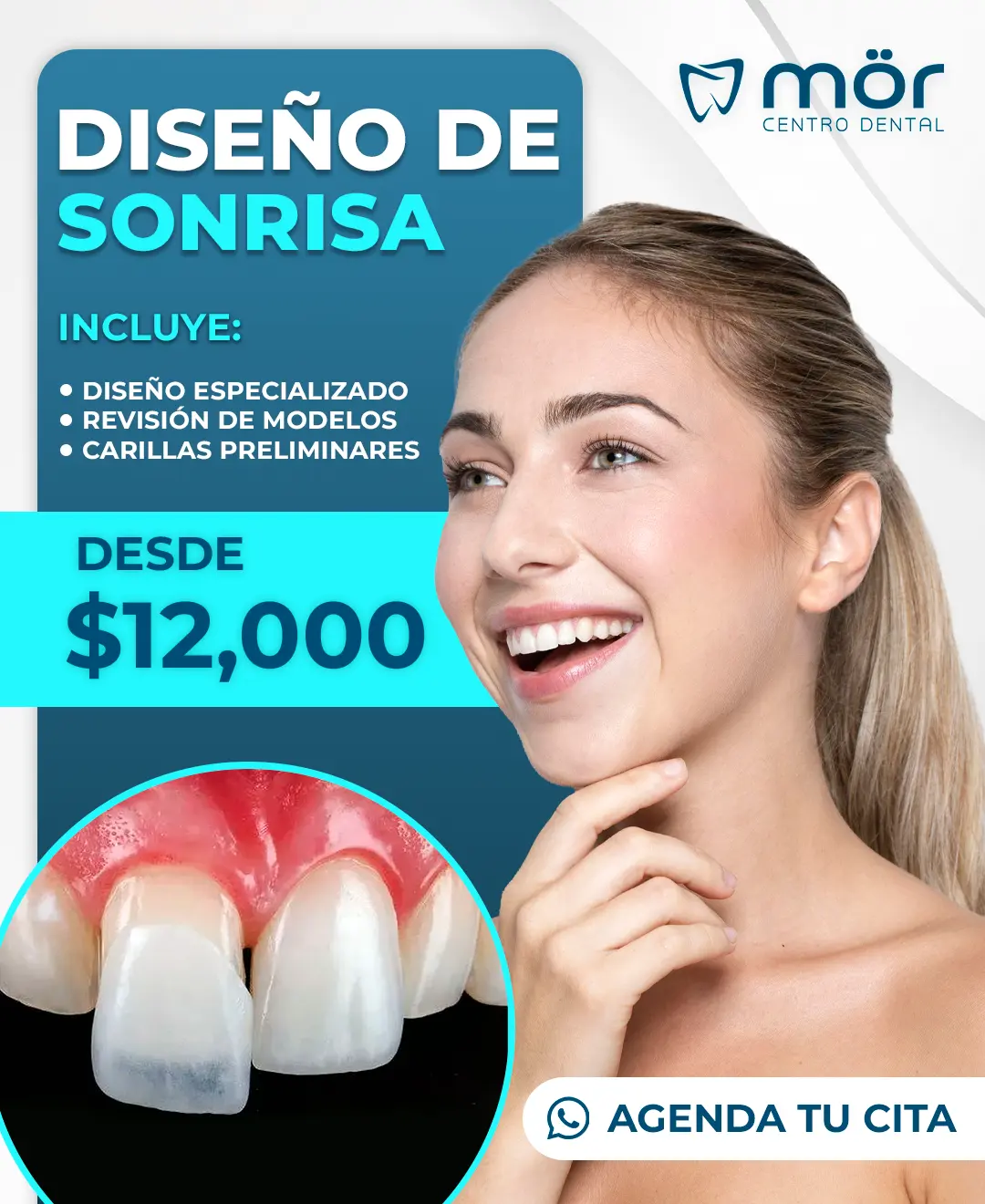 Promoción blanquamiento dental