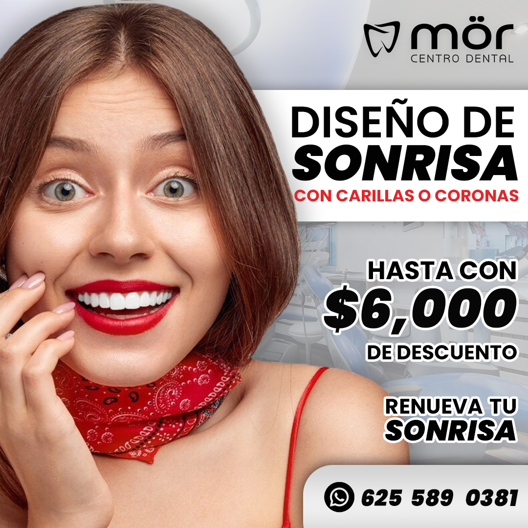 Promoción brackets con 50% de descuento