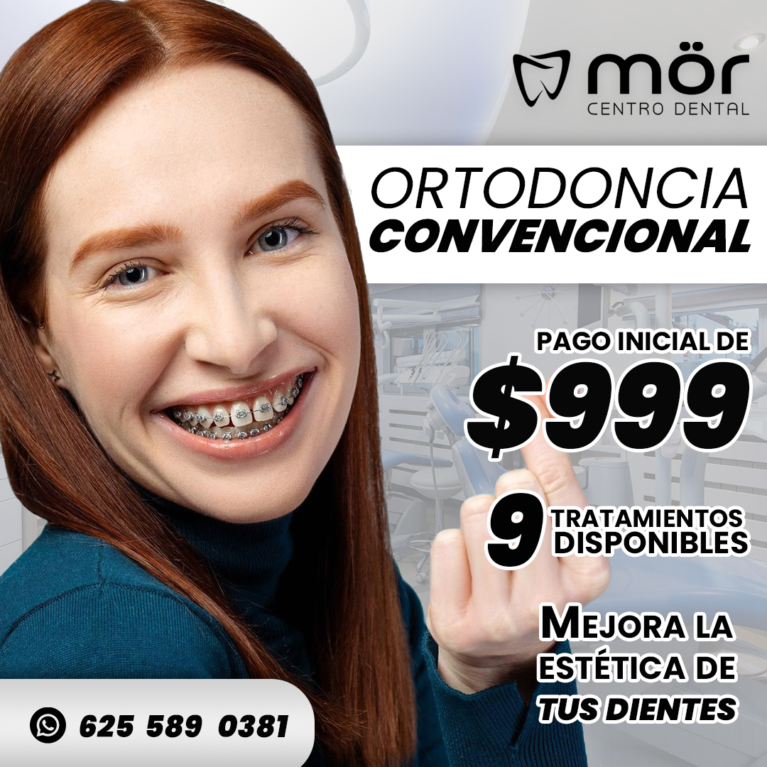 Promoción brackets con 50% de descuento