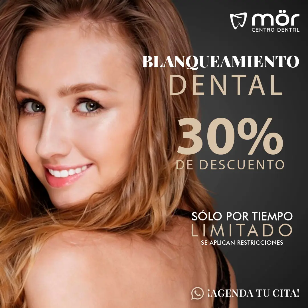 Promoción blanqueamiento dental